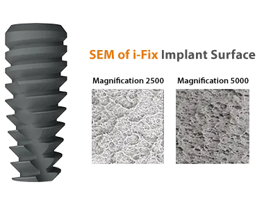 Surface — i-Fix implant design